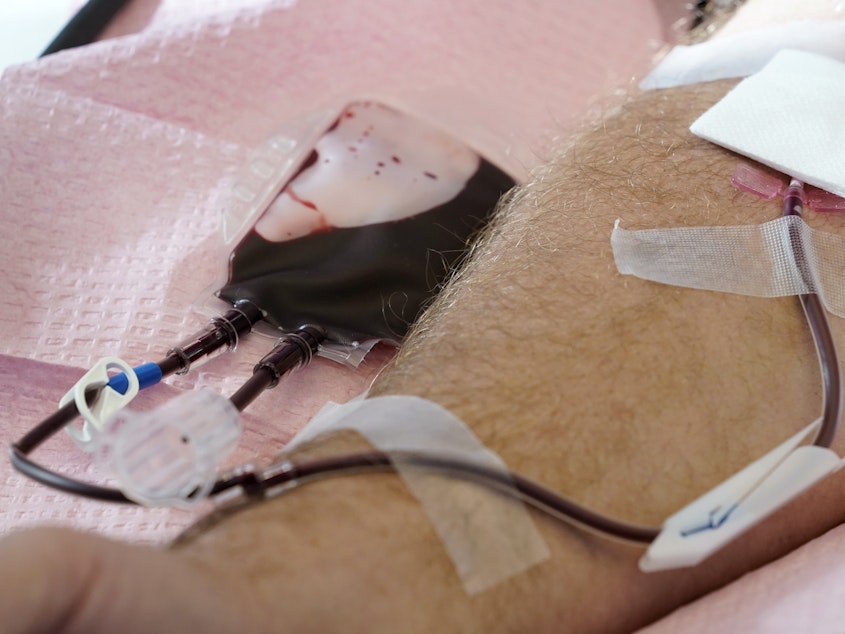 caption: The U.S. is moving to ease restrictions on blood donations from gay and bisexual men and other groups that traditionally face higher risks of HIV. 