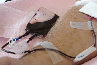 caption: The U.S. is moving to ease restrictions on blood donations from gay and bisexual men and other groups that traditionally face higher risks of HIV. 