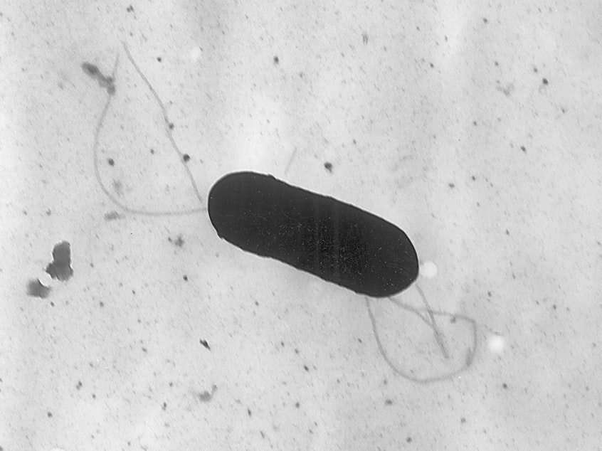 caption: A listeria bacterium seen under an electron microscope. Listeria is not typically life-threatening, but those over 65, pregnant or with compromised immune systems are deemed high-risk when exposed to the bacteria.