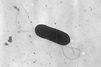 caption: A listeria bacterium seen under an electron microscope. Listeria is not typically life-threatening, but those over 65, pregnant or with compromised immune systems are deemed high-risk when exposed to the bacteria.