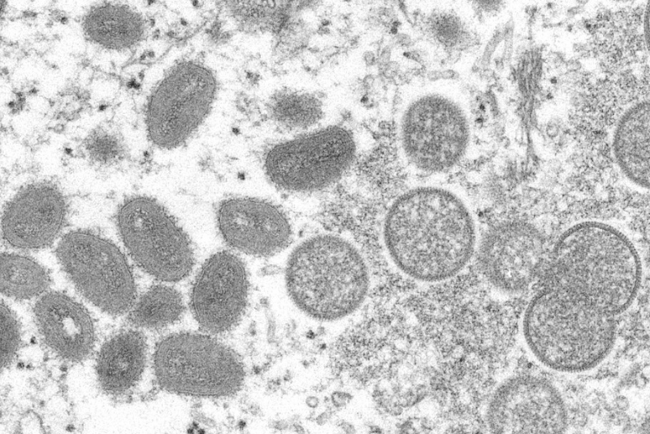 caption: This 2003 electron microscope image made available by the Centers for Disease Control and Prevention shows mature, oval-shaped monkeypox virions, left, and spherical immature virions, right, obtained from a sample of human skin associated with the 2003 prairie dog outbreak.