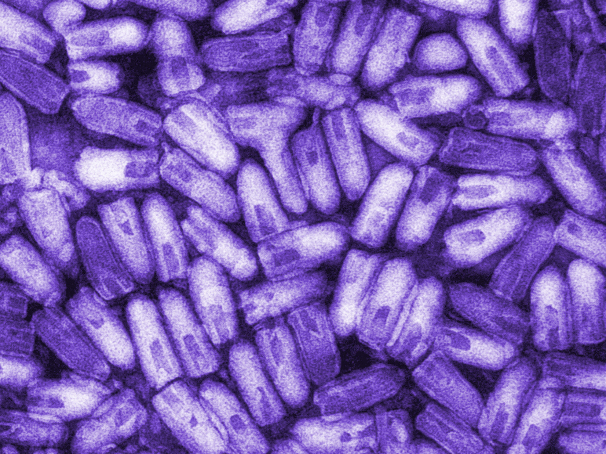 caption: The infectious and contagious rabies virus, shown here in a colorized micrograph, can be transmitted to humans through the bite or saliva of an infected animal. Thanks to protective vaccination of pets, rabies was eliminated from the U.S. dog population in 2007, though a bite from infected bats, skunks and raccoons can still transmit the virus.