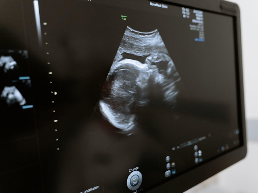 caption: Vaccinating pregnant women against the coronavirus also helps protect their babies against COVID-19 after they are born, according to new research.