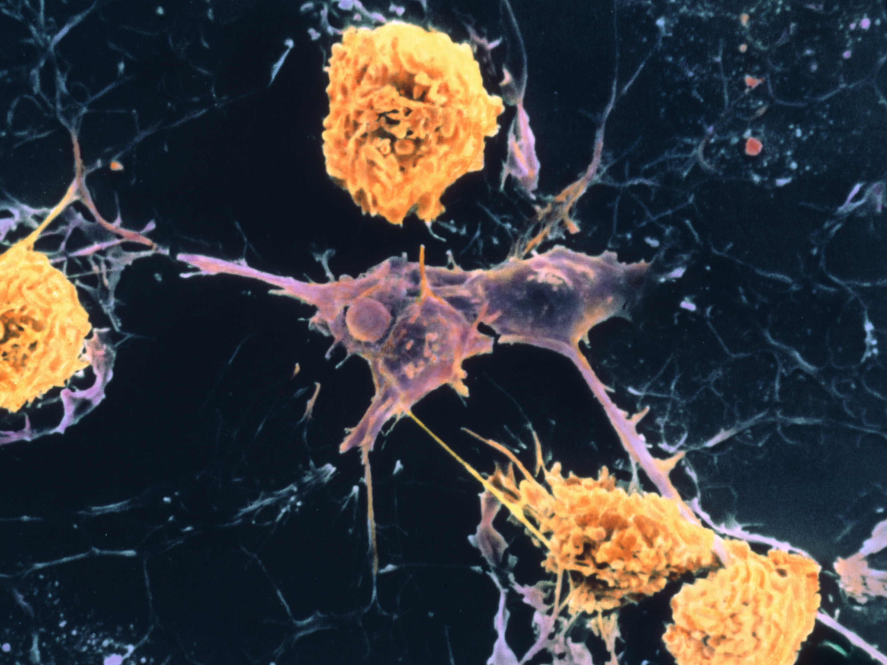 caption: A scanning electron micrograph shows microglial cells (yellow) ingesting branched oligodendrocyte cells (purple), a process thought to occur in multiple sclerosis. Oligodendrocytes form insulating myelin sheaths around nerve axons in the central nervous system.