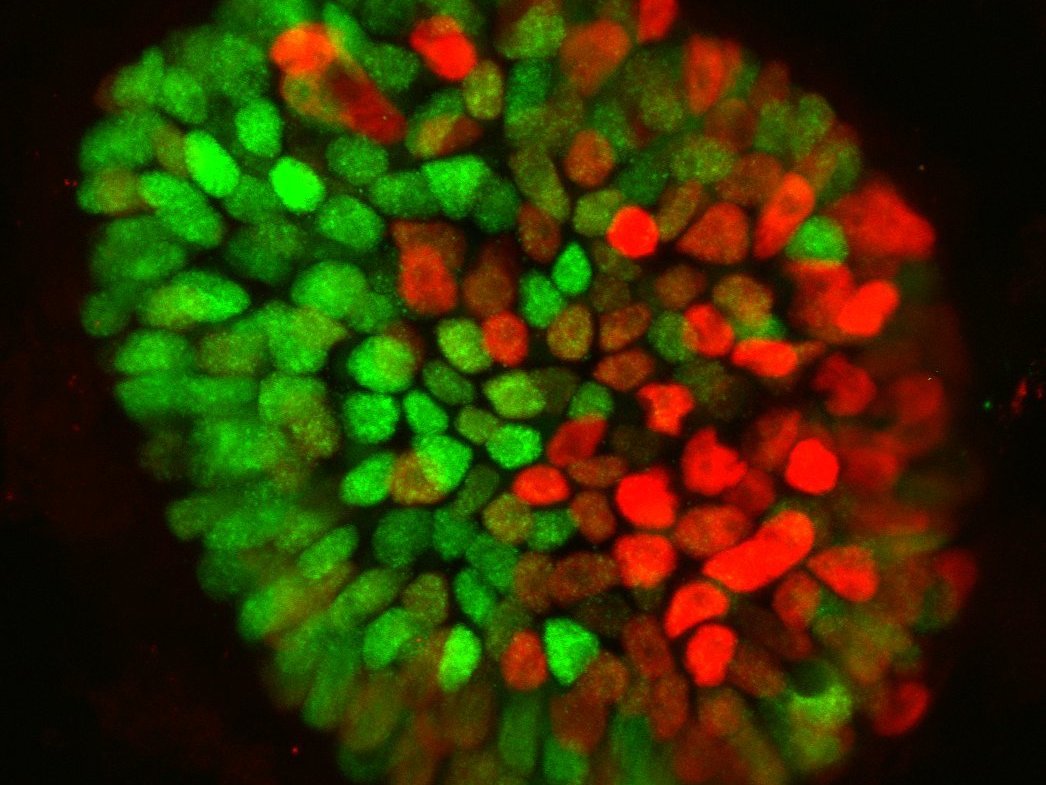 caption: Researchers created a structure using embryonic stem cells that mimics the earliest stages of human development in the womb. This image shows the structure breaking the symmetry of the sphere, which starts the development of more complex structures that eventually develop into a fetus.