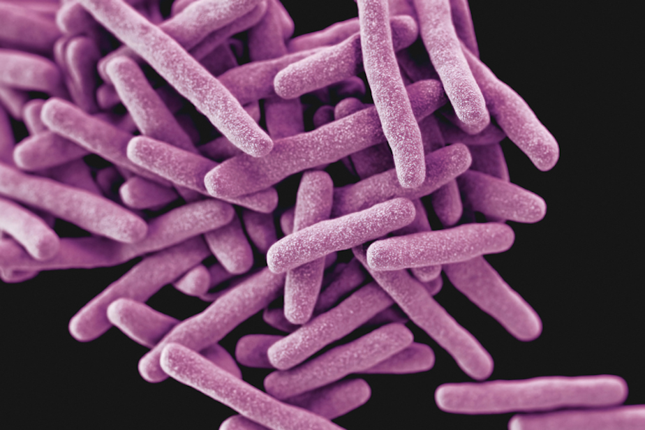 caption: A 3D computer generated image of drug-resistant, mycobacterium tuberculosis bacteria, the pathogen responsible for causing the disease tuberculosis (TB).