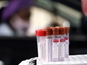 caption: Test kits are shown at a United Memorial Medical Center COVID-19 testing site in Houston on Friday.