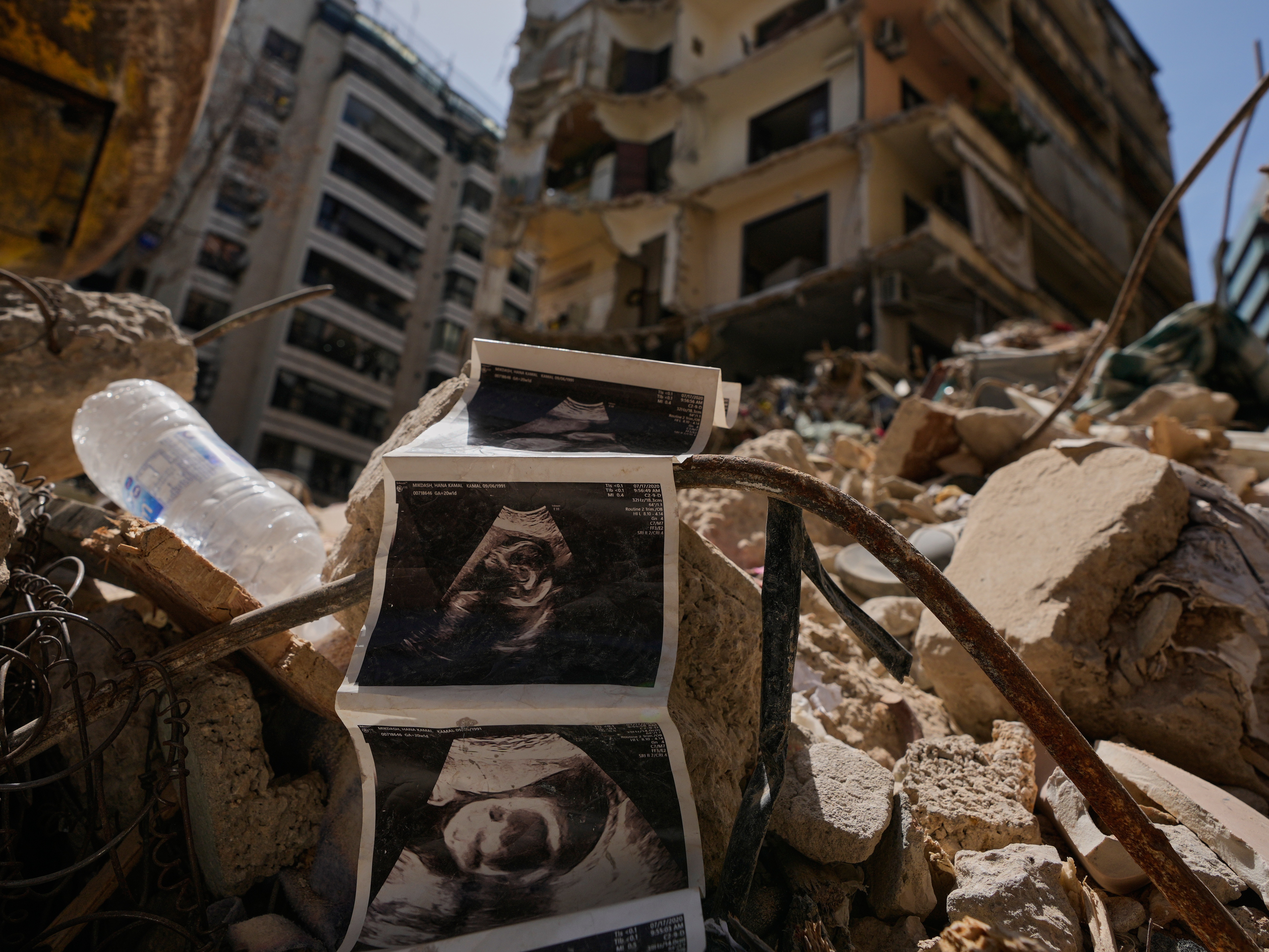 caption: Sonogram images of a baby lie among the rubble of a destroyed building that was hit a week ago in an Israeli airstrike, in central Beirut, Lebanon April 16, 2026.
