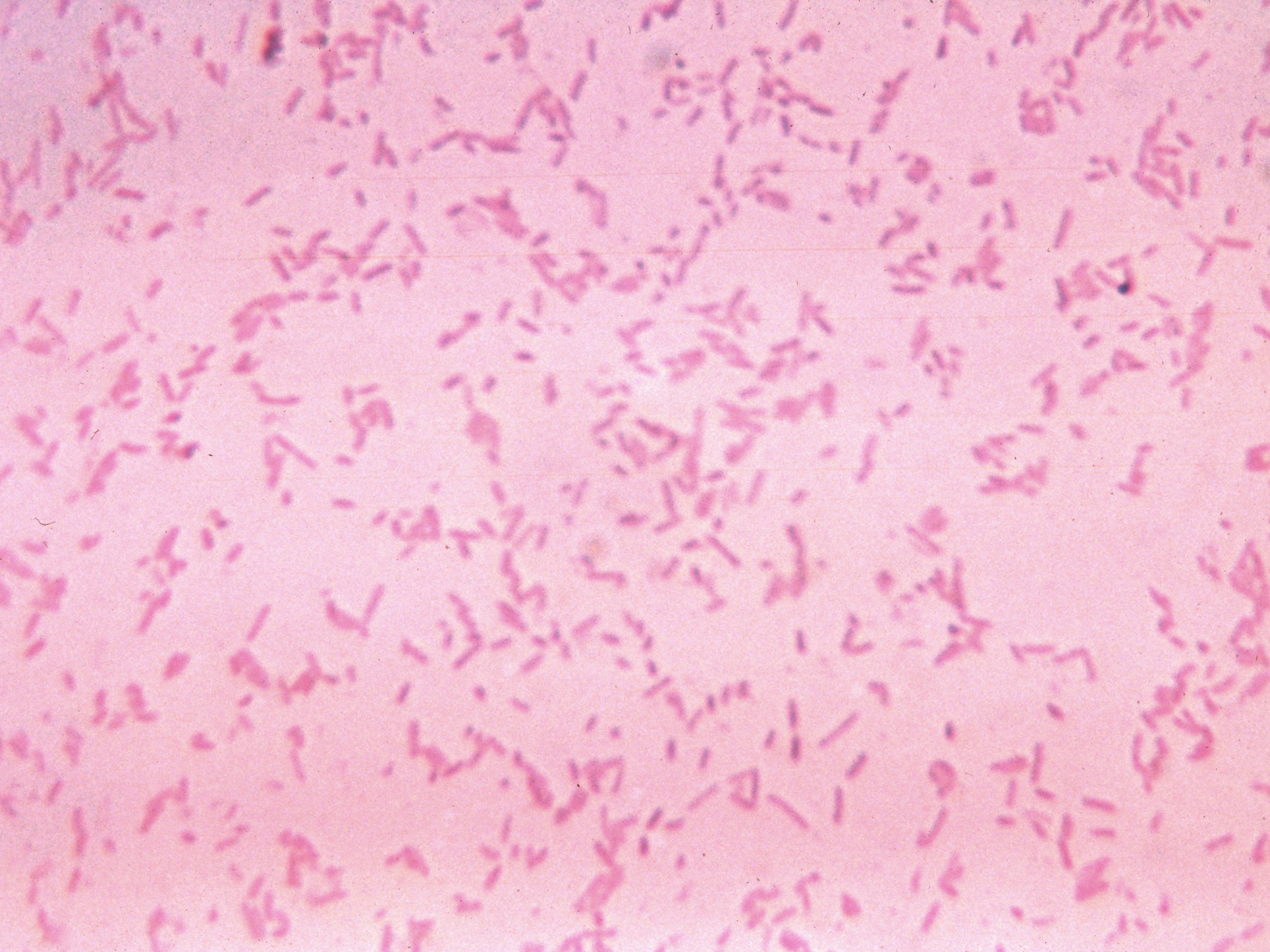 caption: This micrograph image depicts a gastrointestinal bacteria that can become pathogenic after trauma, surgery or other disruptions.