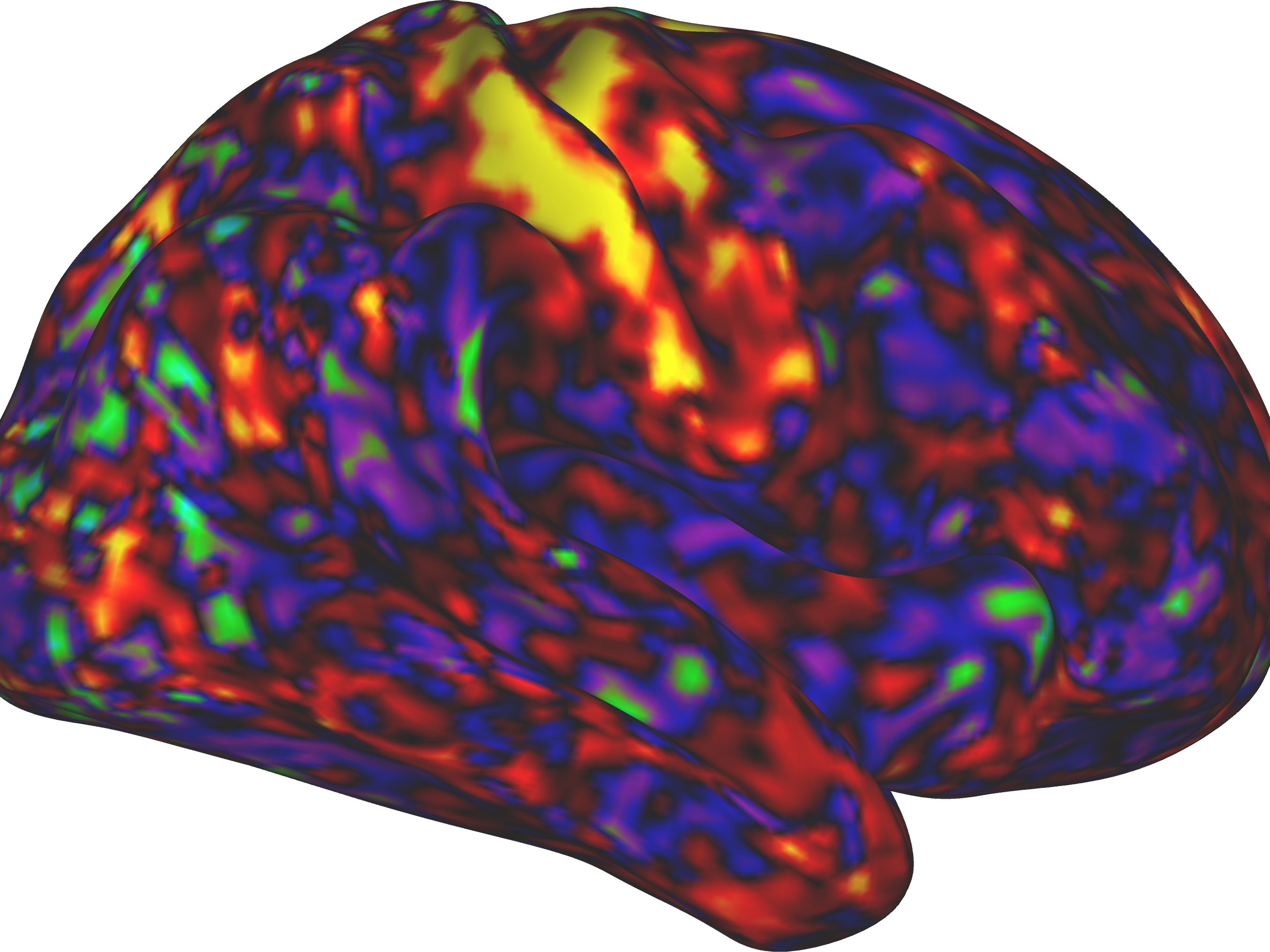 caption: An image of the brain shows that as stimulants increase arousal, they calm (darker colors) various parts of the brain.