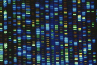 caption: Results from a DNA sequencer used in the Human Genome Project.