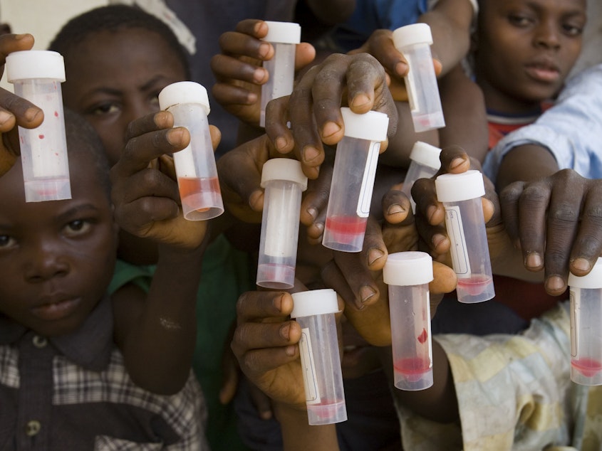 caption: Children in Nasarawa, Nigeria, hold samples of their urine specimens. Blood in the urine is a sign of Schistosomiasis, a microscopic worm that, left untreated, can damage organs as well as cause learning delays. A new pill has been developed to treat preschoolers.