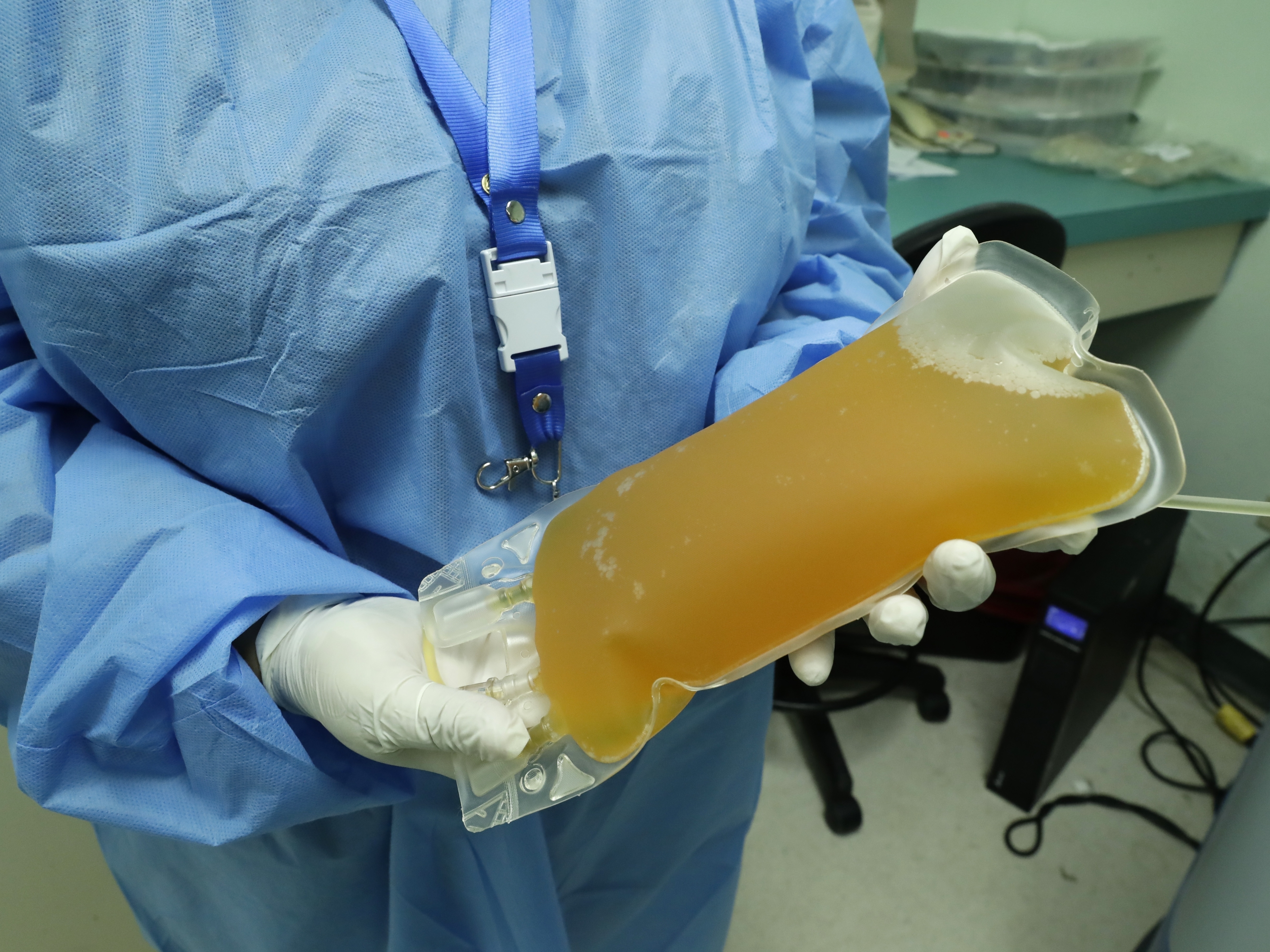 caption: Convalescent serum or blood plasma from a recovered COVID-19 patients is being studied as a treatment for others with the disease. The FDA is holding off on giving it emergency use authorization.