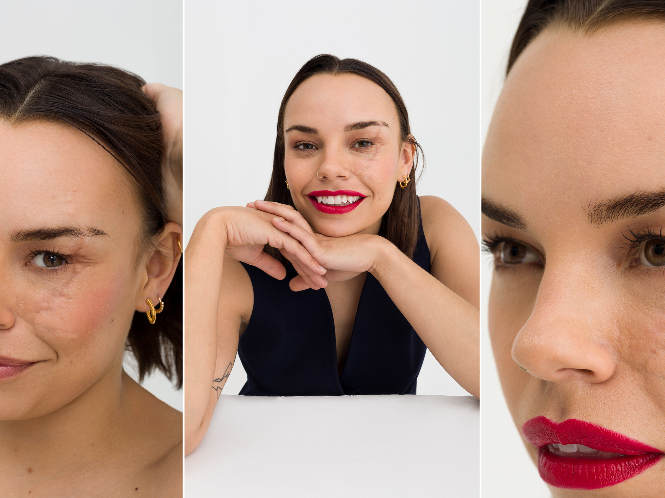 caption: Phyllida Swift posing with her scar.