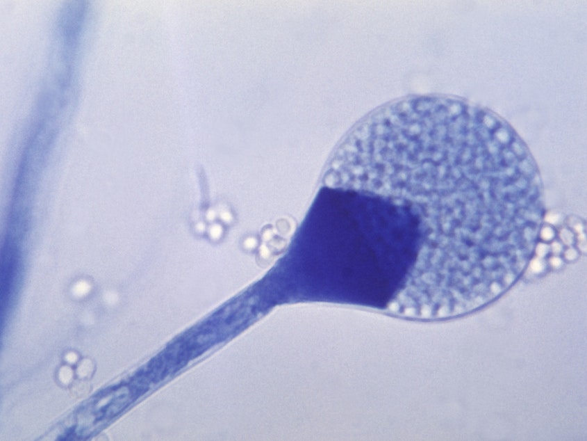 caption: A light micrograph of a mature sporangium of a mucor fungus. India is seeing a rise in cases of mucormycosis, a rare but dangerous fungal infection.