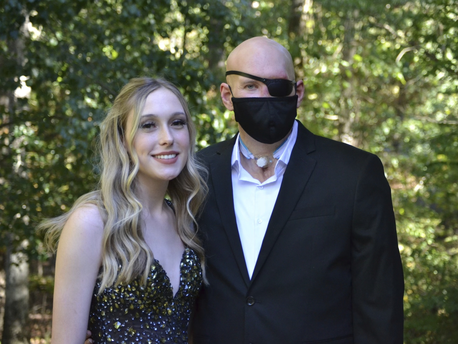 caption: This family photo shows Aaron James and his daughter, Allie in September 2022. Aaron was working for a power line company in June 2021 when he was shocked by a live wire. He nearly died. Ultimately he lost his left arm, requiring a prosthetic. His damaged left eye was so painful it had to be removed.