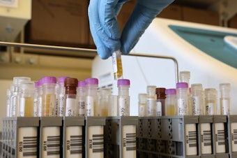 caption: Researchers at the University of Washington Medicine Retrovirology Lab at Harborview Medical Center in Seattle process samples from Novavax's phase 3 COVID-19 vaccine clinical trial in February 2021.