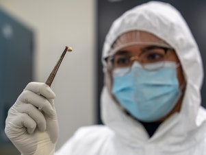 caption: Using DNA extracted from teeth of people who died during and after the Black Death pandemic, researchers were able to identify genetic differences between those who survived and who died from the virus.