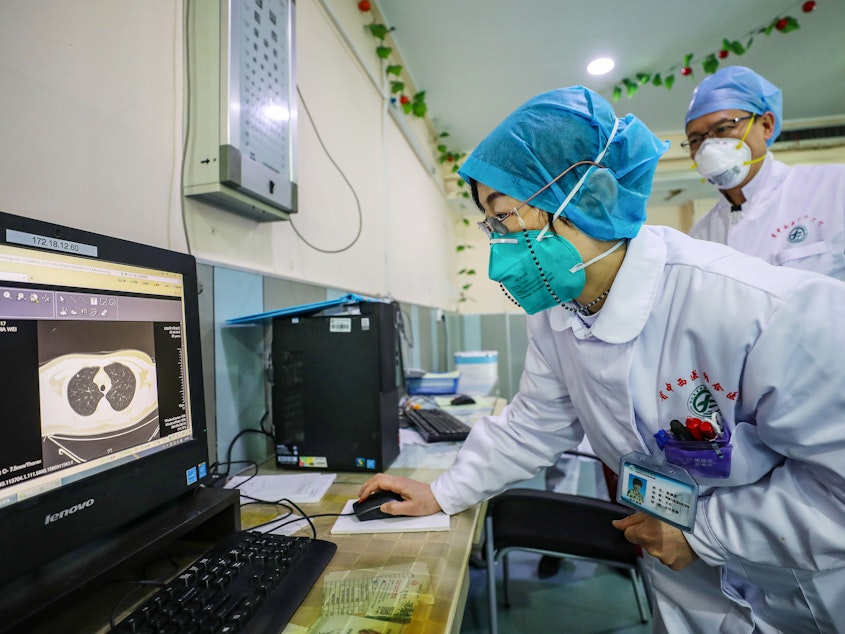 caption: A doctor wearing a face mask looks at a CT image of a lung of a patient at a hospital in Wuhan, China.