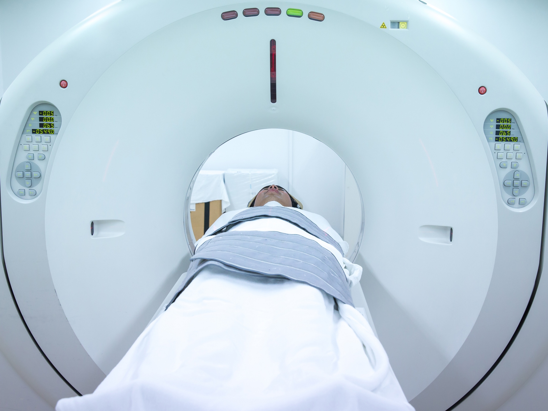 caption: CT scans use ionizing radiation to create cross-sectional images of the body, providing more detail than X-rays.