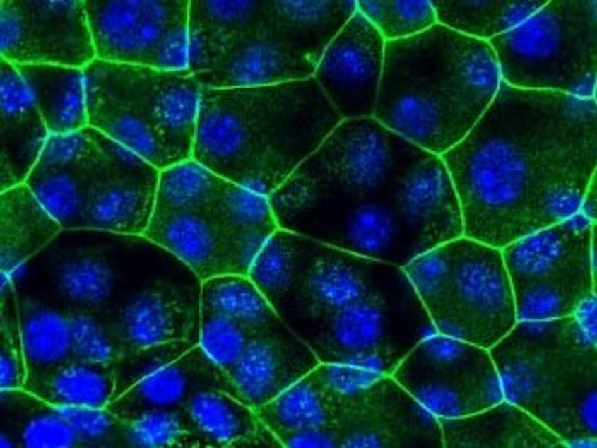 caption: Microscope images of urinary tract cells from mice that were not given a UTI (naïve) and those that were susceptible to recurrent UTIs (sensitized). Cells are outlined in green and the DNA in each cell glows blue. The cells susceptible to recurrent UTIs are smaller.