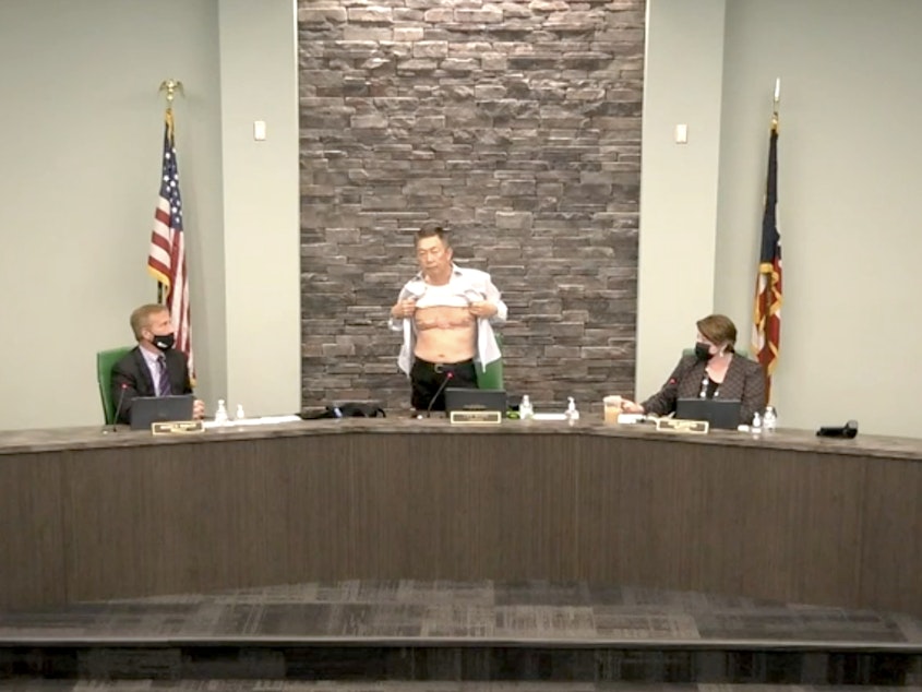 caption: West Chester, Ohio, Board of Trustees Chairman Lee Wong bares his chest at a meeting Tuesday. Those scars, suffered during his U.S. military service, are "proof" of his patriotism, he said.