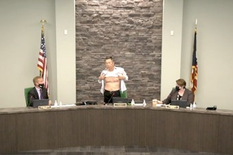 caption: West Chester, Ohio, Board of Trustees Chairman Lee Wong bares his chest at a meeting Tuesday. Those scars, suffered during his U.S. military service, are "proof" of his patriotism, he said.