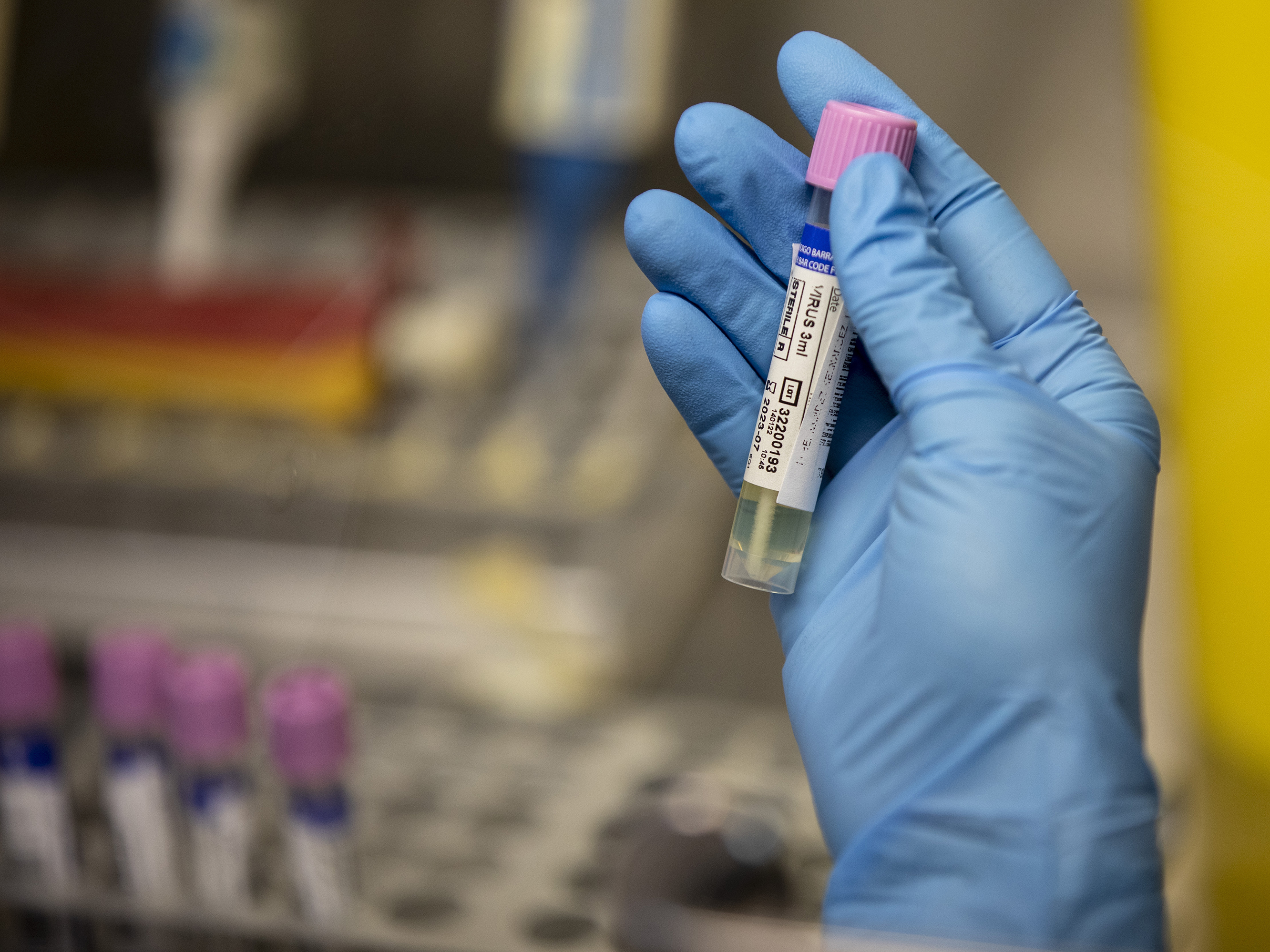 caption: A medical technician shows a suspected monkeypox sample at the microbiology laboratory of La Paz Hospital on June 6 in Madrid. The World Health Organization is working with experts on changing the name of the virus.