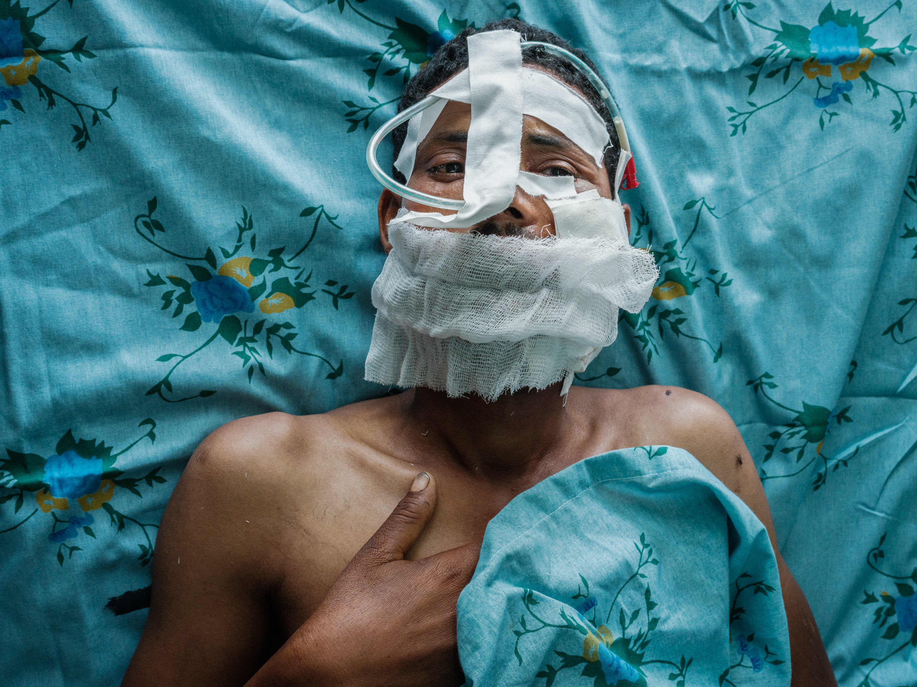 caption: An injured Tigray People's Liberation Front fighter who was shot in the cheek recovers after surgery at the Ayder Comprehensive Specialized Hospital in Mekele, the capital of Ethiopia's Tigray region. It's the only place in Tigray currently conducting surgery. Elsewhere, "they are stopped because there is no supply, there is no electricity, and there is no fuel," says one Tigray doctor.