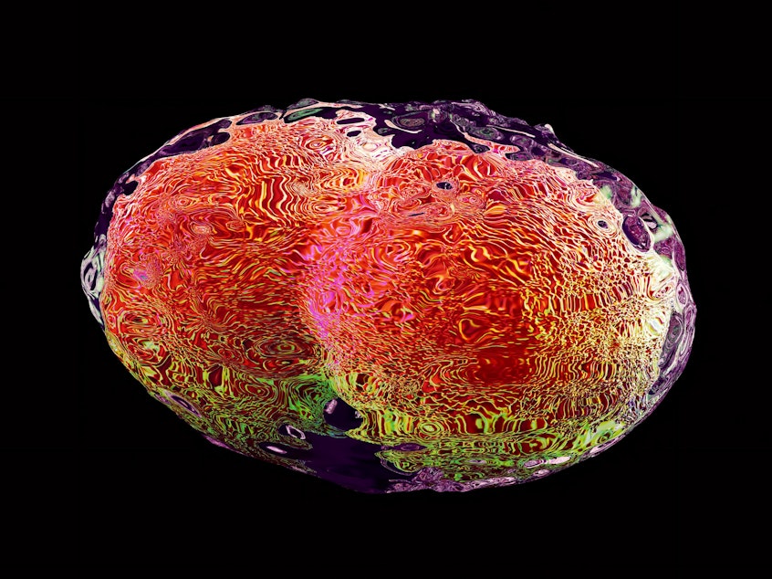caption: A computer illustration of the virus that causes smallpox. The virus was eradicated in 1980, but live samples are kept in two known labs for research.