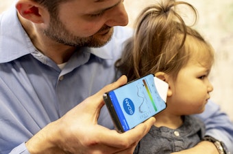 caption: Dr. Randall Bly, an assistant professor of otolaryngology-head and neck surgery at the University of Washington School of Medicine who practices at Seattle Children's Hospital, uses the experimental smartphone app and a paper funnel to check his daughter's ear.