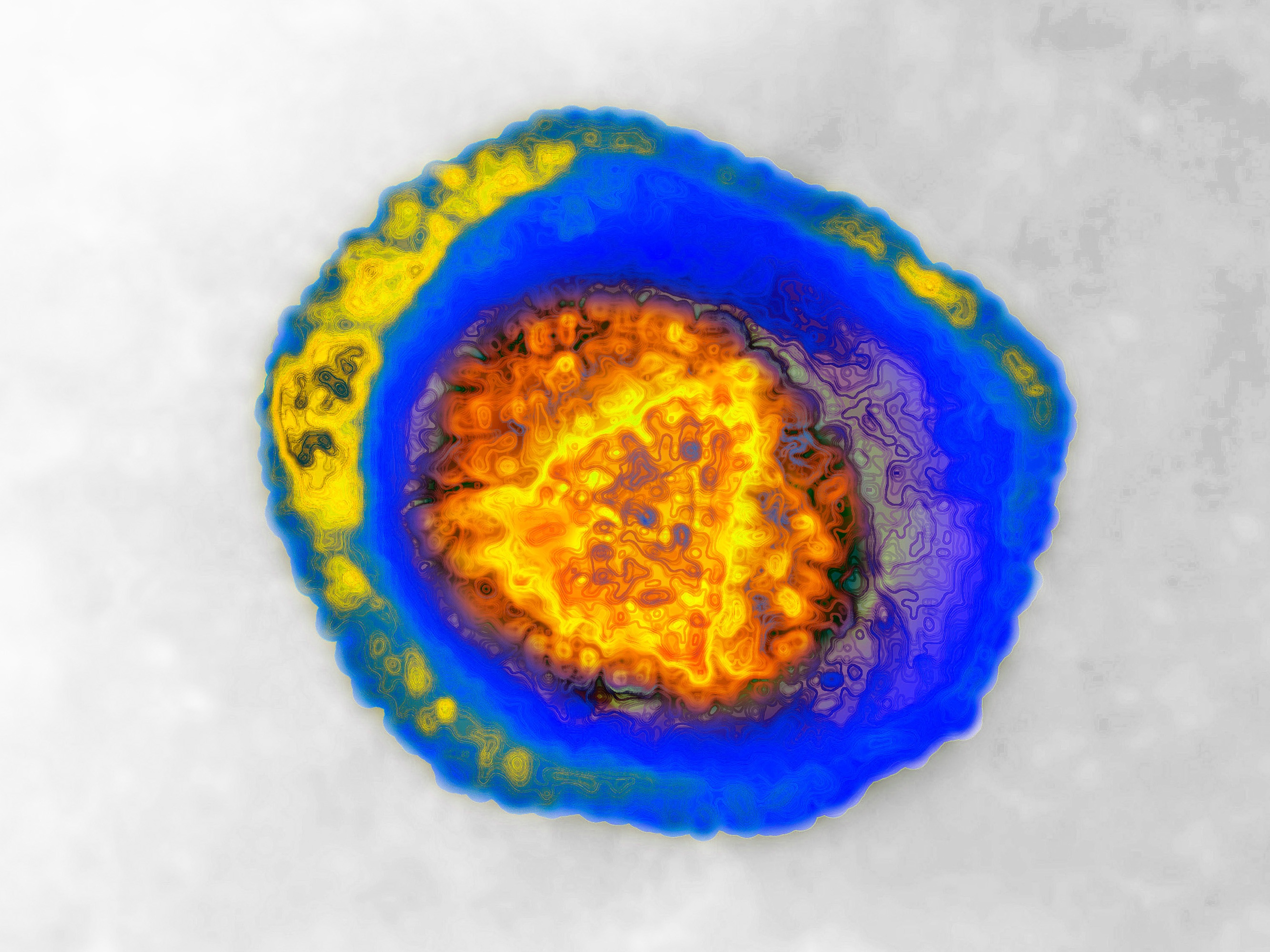 caption: An image of the human herpes virus, HSV, taken with transmission electron microscope. Two types can cause genital herpes: HSV-1 and HSV-2.