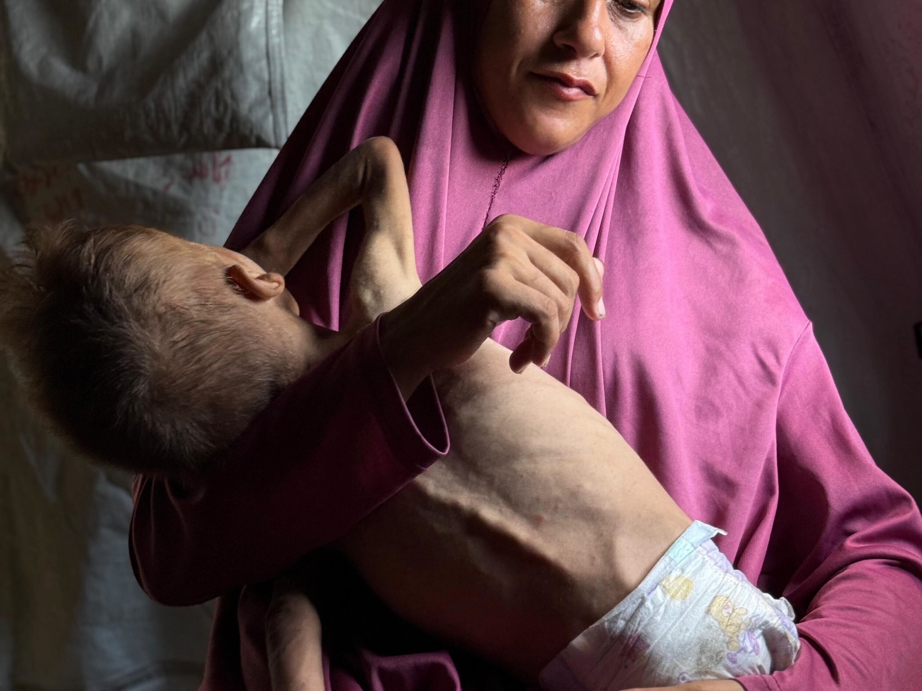 caption: Hidaya Al-Motawaq cradles her son Mohammad, who is a year-and-a-half old and weighs just under 10 pounds.