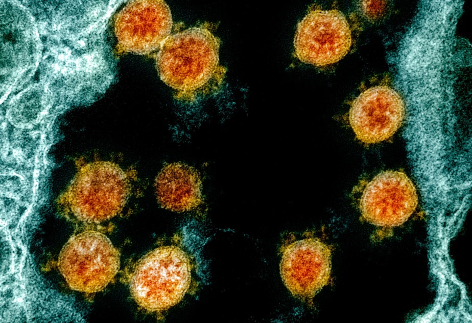 caption: Internationally, scientists now<strong data-stringify-type="bold"> </strong>have on file the genomes of more than 47,000 different samples of the virus that causes COVID-19 — up from just one in January. Here's a transmission electron micrograph of SARS-CoV-2 virus particles (orange) isolated from a patient.