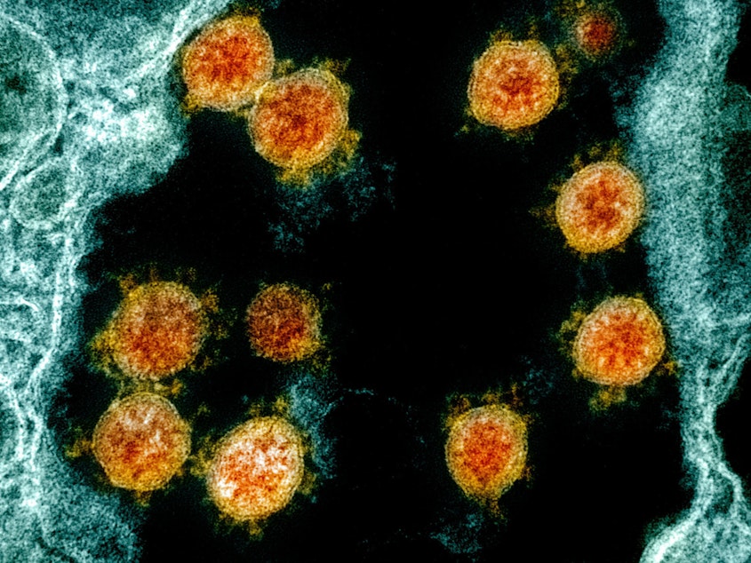 caption: Internationally, scientists now<strong data-stringify-type="bold"> </strong>have on file the genomes of more than 47,000 different samples of the virus that causes COVID-19 — up from just one in January. Here's a transmission electron micrograph of SARS-CoV-2 virus particles (orange) isolated from a patient.