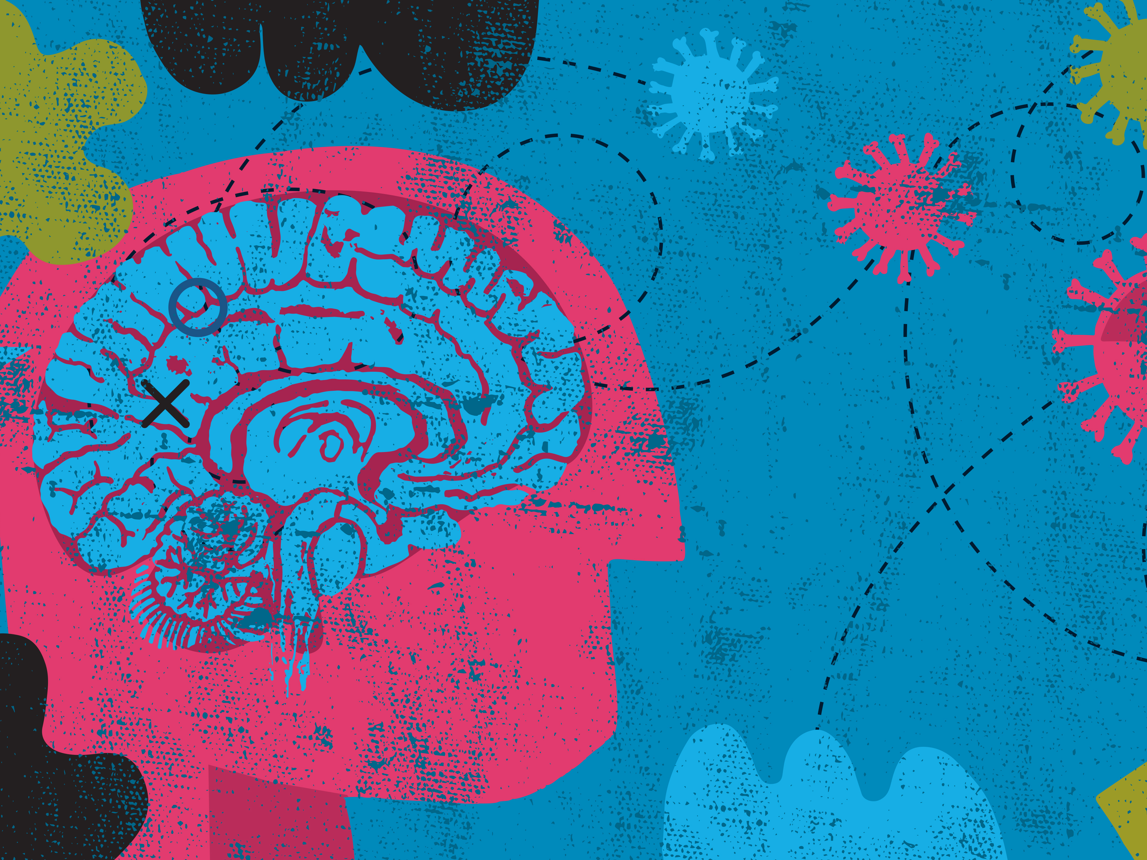 caption: Scientists are learning more about how long COVID affects the brain.