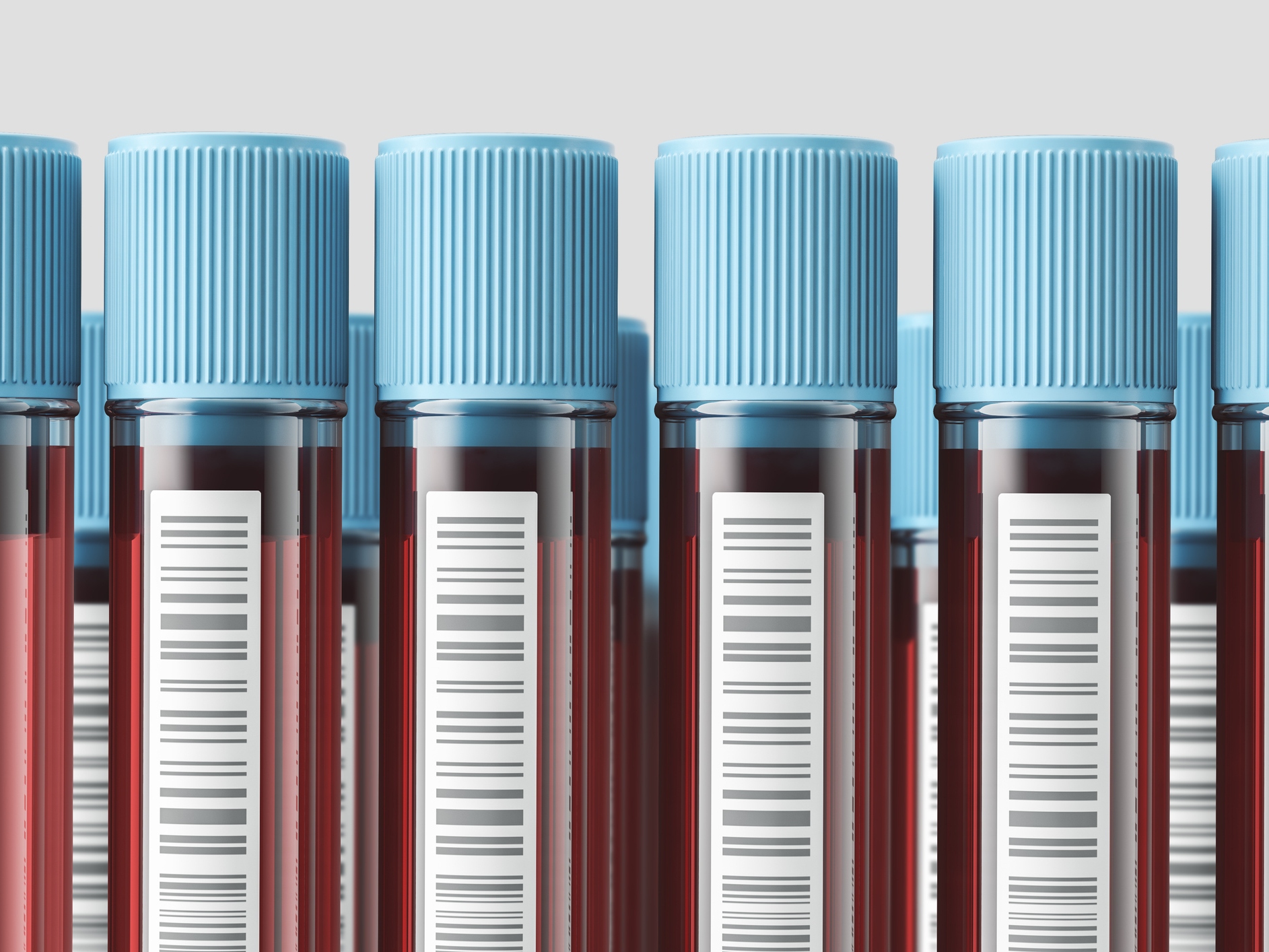 Vertical test tubes with blood