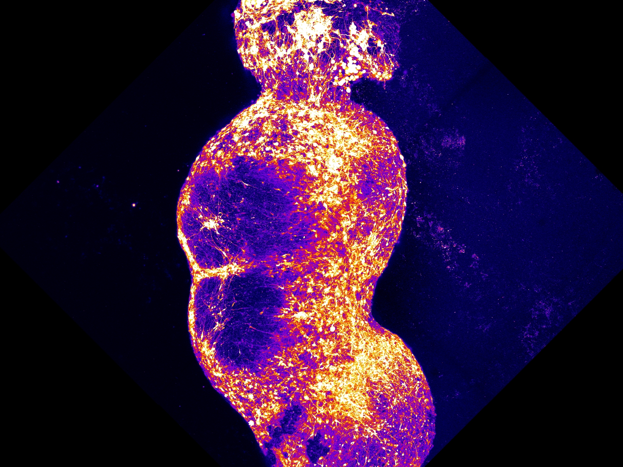 caption: Researchers integrated four organoids that represent the four components of the human sensory pathway, along which pain signals are conveyed to the brain. Stimulation of the sensory organoid (top) by substances, such as capsaicin, triggers neuronal activity that is then transmitted throughout the rest of the organoids.