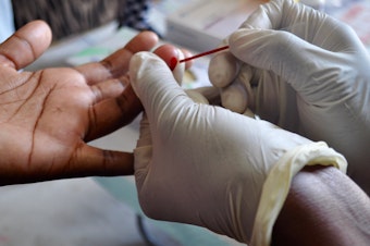 Drawing blood to test for HIV.
