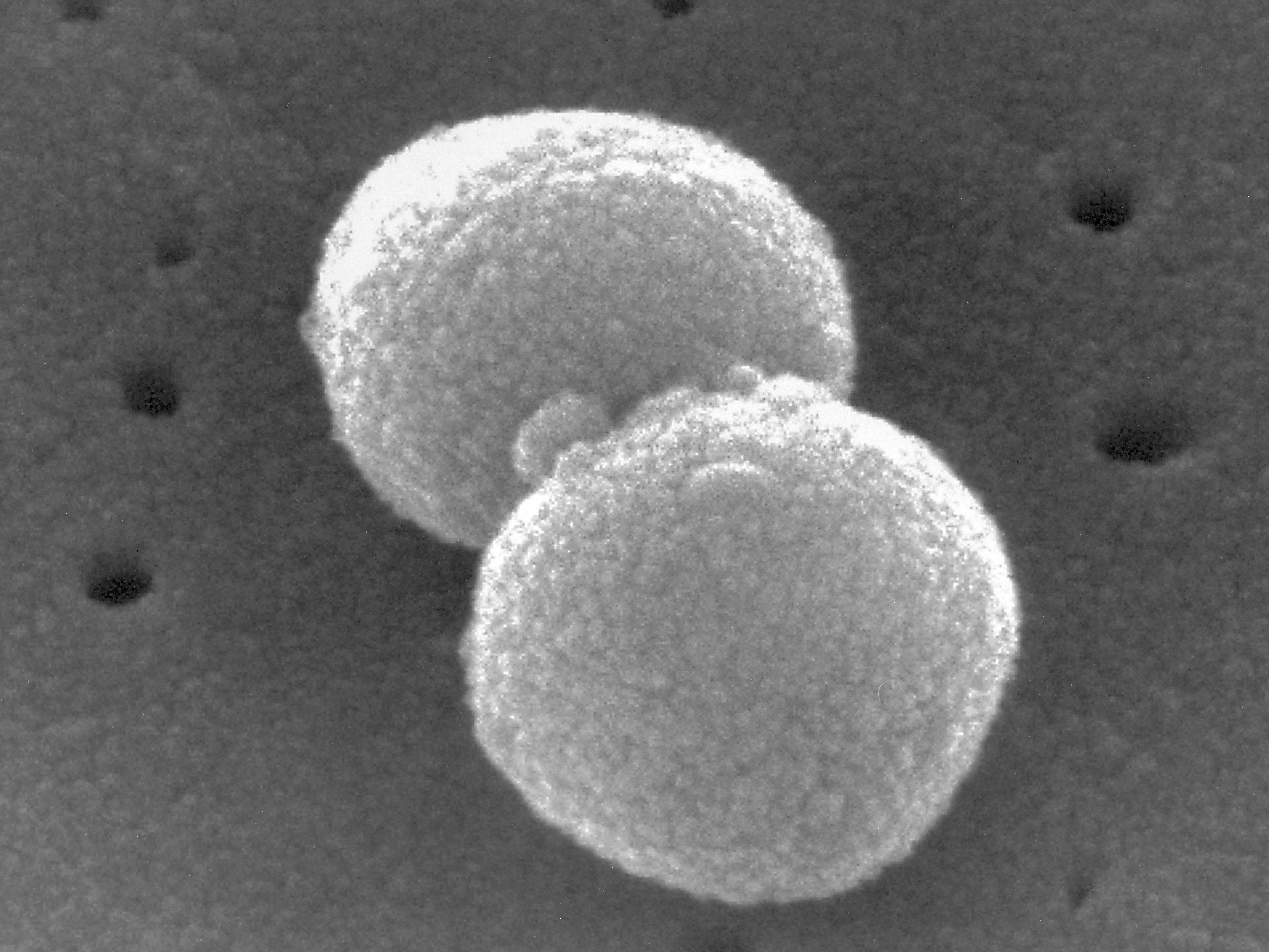 caption: This electron microscopic image provided by the Centers for Disease Control and Prevention shows two, round-shaped, Gram-positive, Streptococcus pneumoniae bacteria.