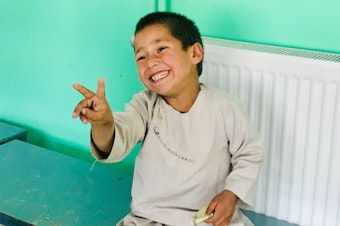 caption: Sayeed Rehman, a 5-year-old Afghan boy, was delighted to get a new prosthetic leg that fit his growing body. His leg was amputated after he was caught in crossfire as an 8-month-old baby.