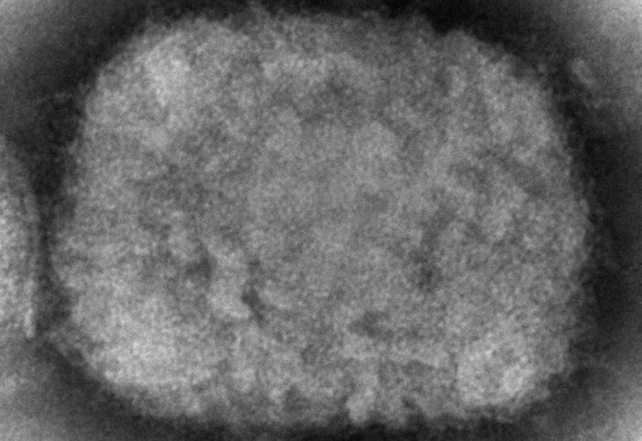 caption: This 2003 electron microscope image made available by the Centers for Disease Control and Prevention shows a monkeypox virion, obtained from a sample associated with the 2003 prairie dog outbreak. The U.S. government is building up its supply of monkeypox vaccine to contend with escalating cases identified in a surprising international outbreak in 2022. 