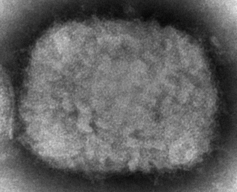 caption: This 2003 electron microscope image made available by the Centers for Disease Control and Prevention shows a monkeypox virion, obtained from a sample associated with the 2003 prairie dog outbreak. The U.S. government is building up its supply of monkeypox vaccine to contend with escalating cases identified in a surprising international outbreak in 2022. 