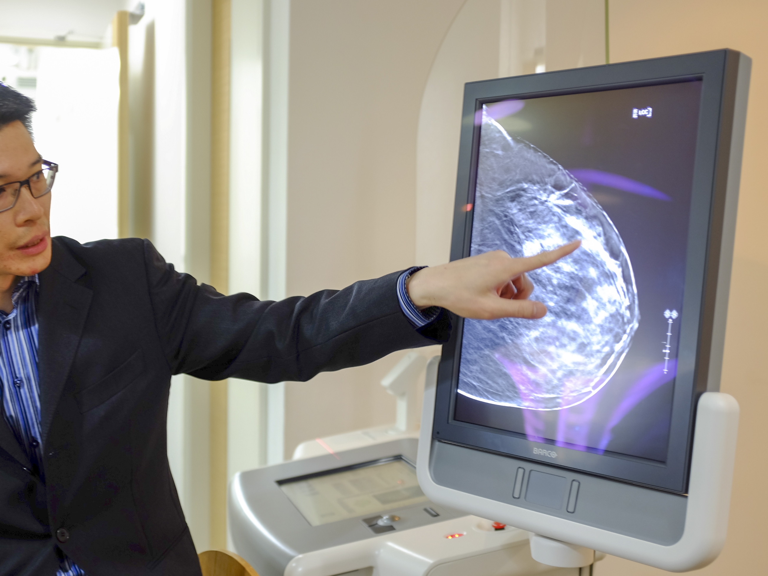caption: A doctor shows what a 3D image of the breast using tomosynthesis (3D mammography) looks like on a screen.