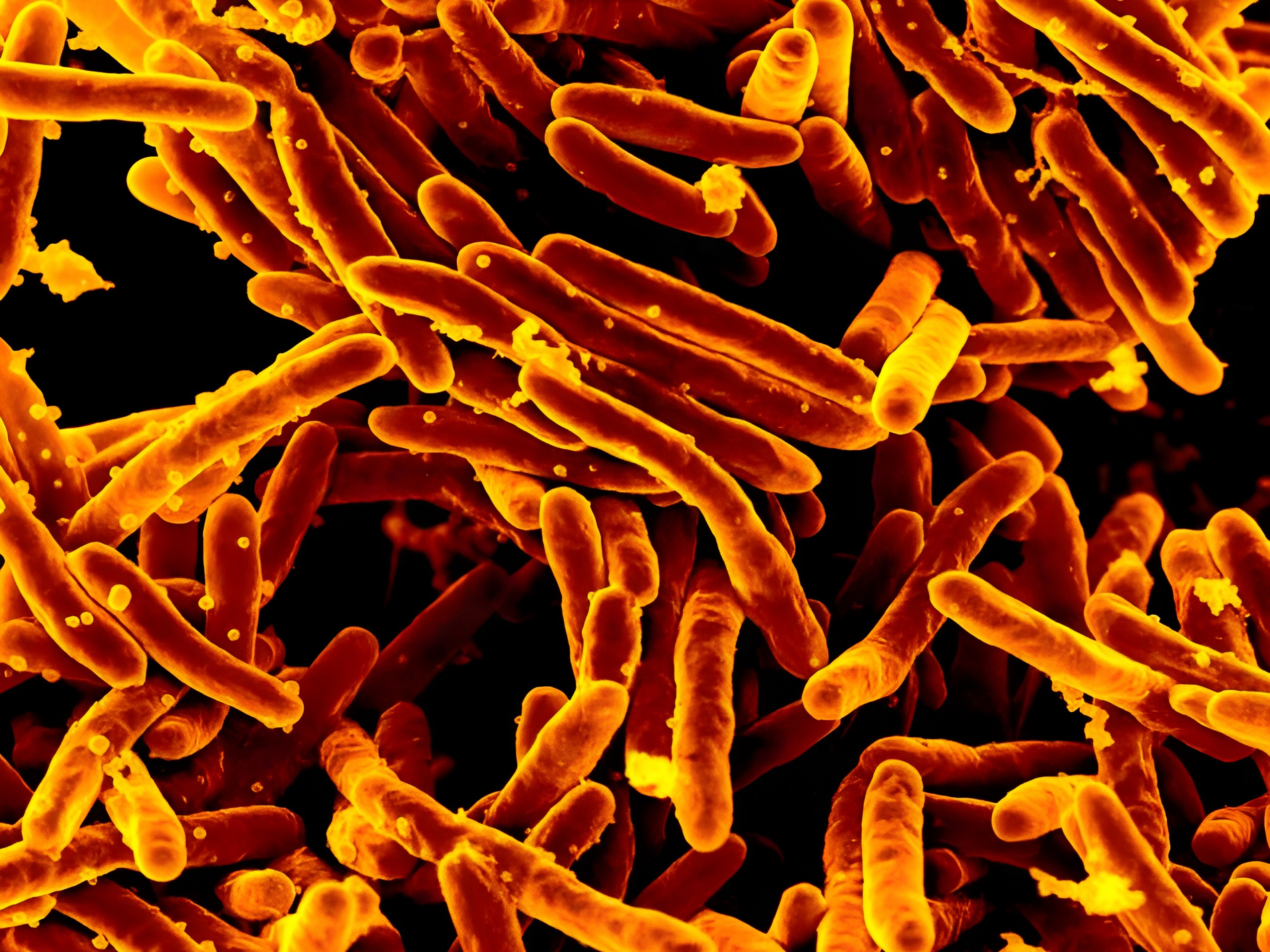caption: A scanning electron micrograph of Mycobacterium tuberculosis bacteria, which cause TB.