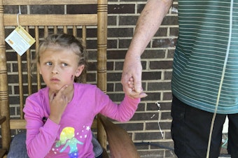 caption: Kinsley White, 6, shows reporters her wound on Thursday in Gastonia, N.C.