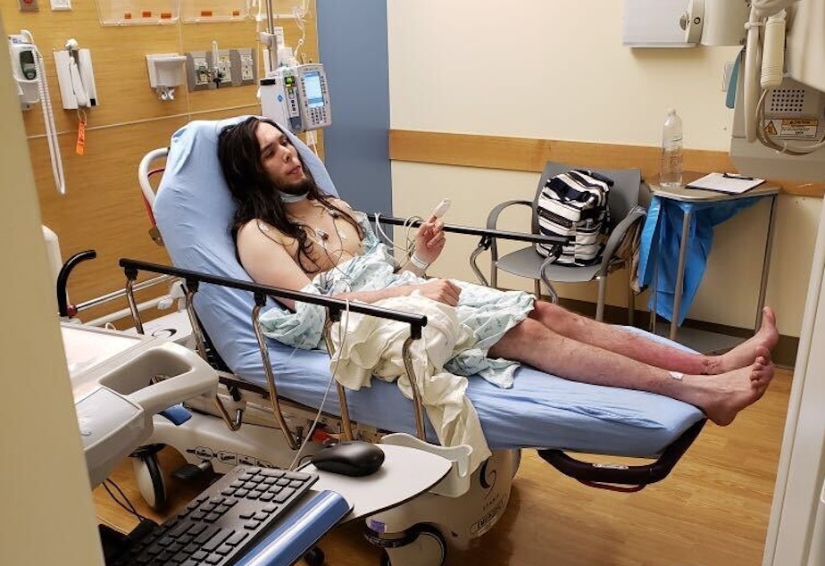 caption: Andrew Devers, 25, recovers after spending nine days in the woods after disappearing June 18 near a hiking trail in North Bend.
