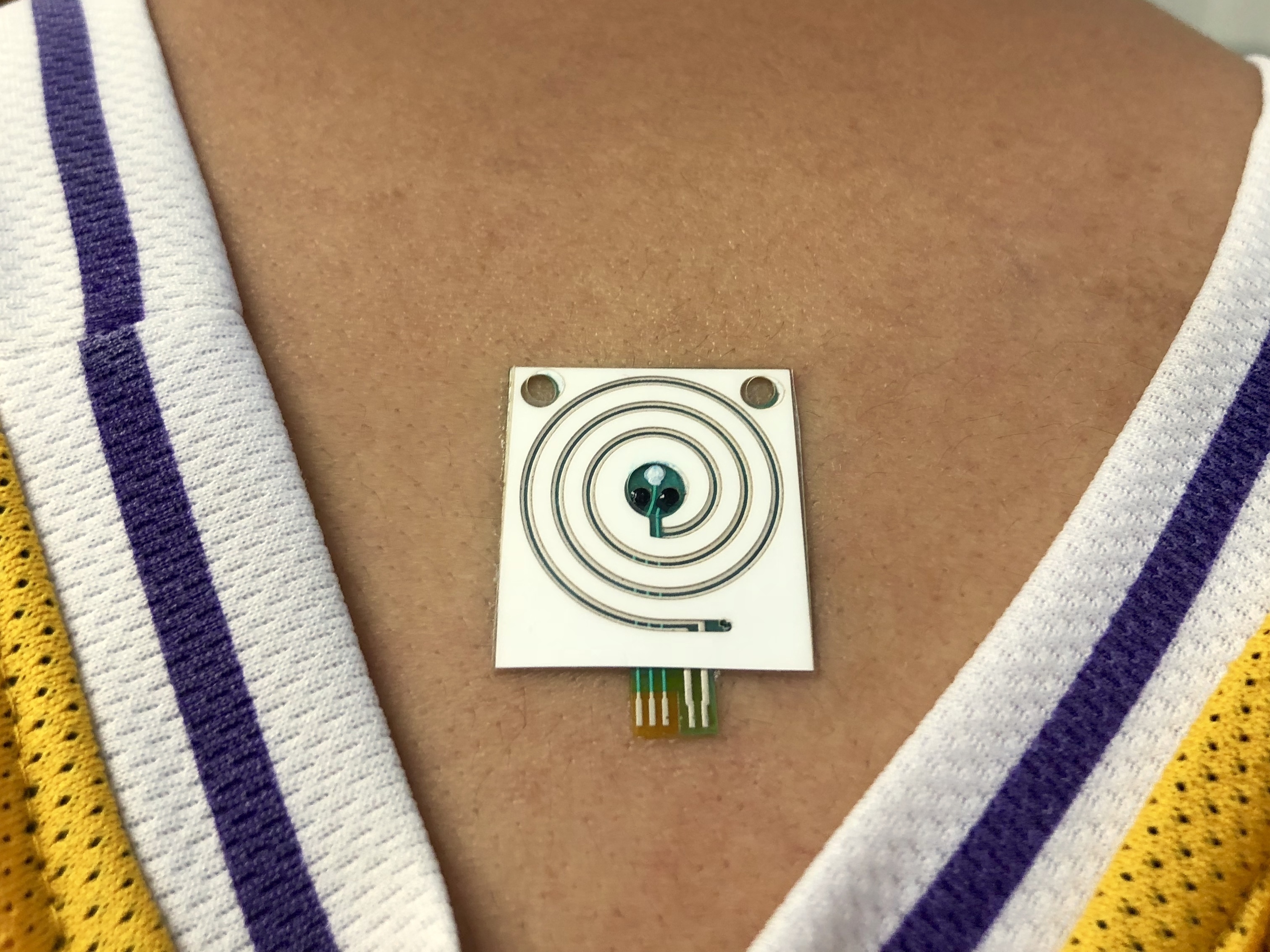 caption: A sensor developed by scientists at U.C. Berkeley can provide real-time measurements of sweat rate and electrolytes in sweat.