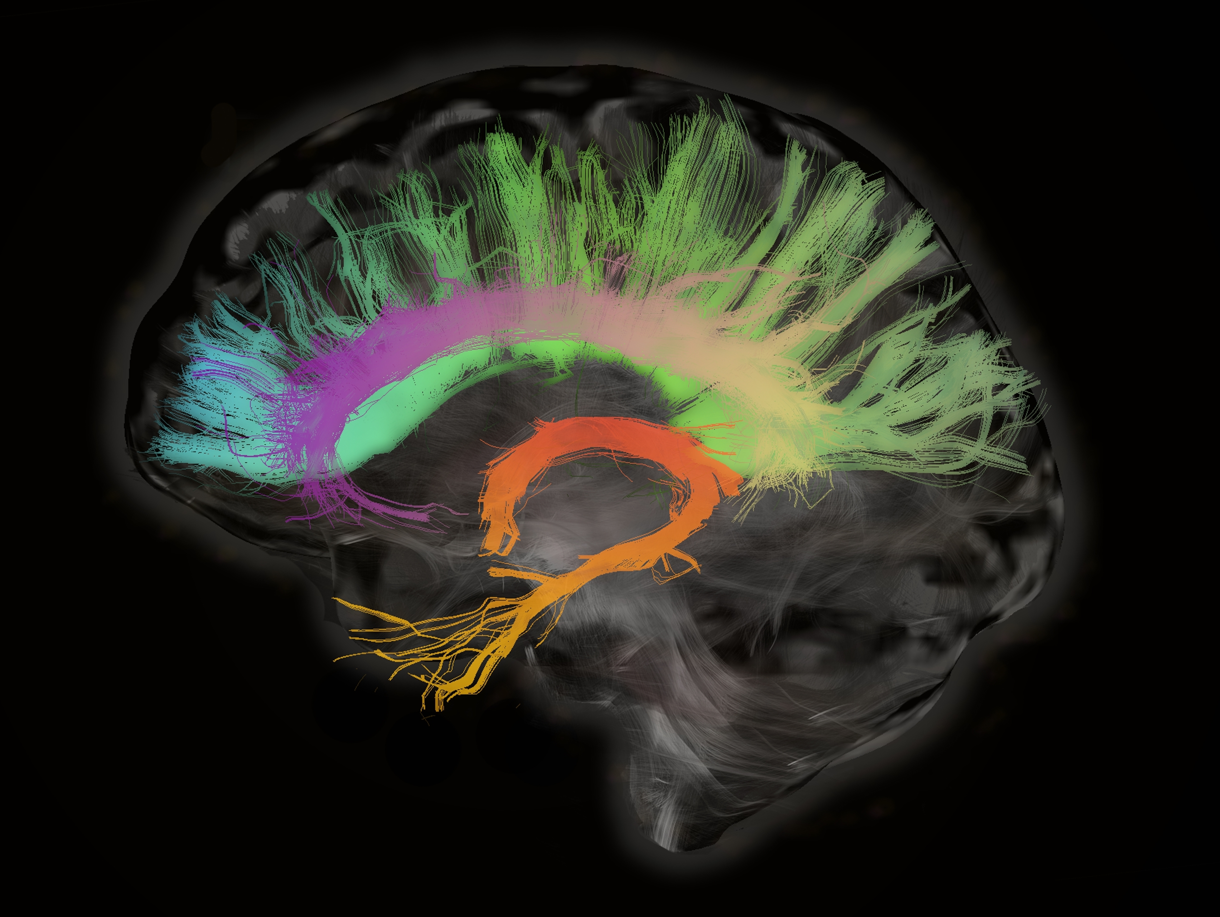 caption: A cross section of the human brain shows fiber tracts involved in aging.