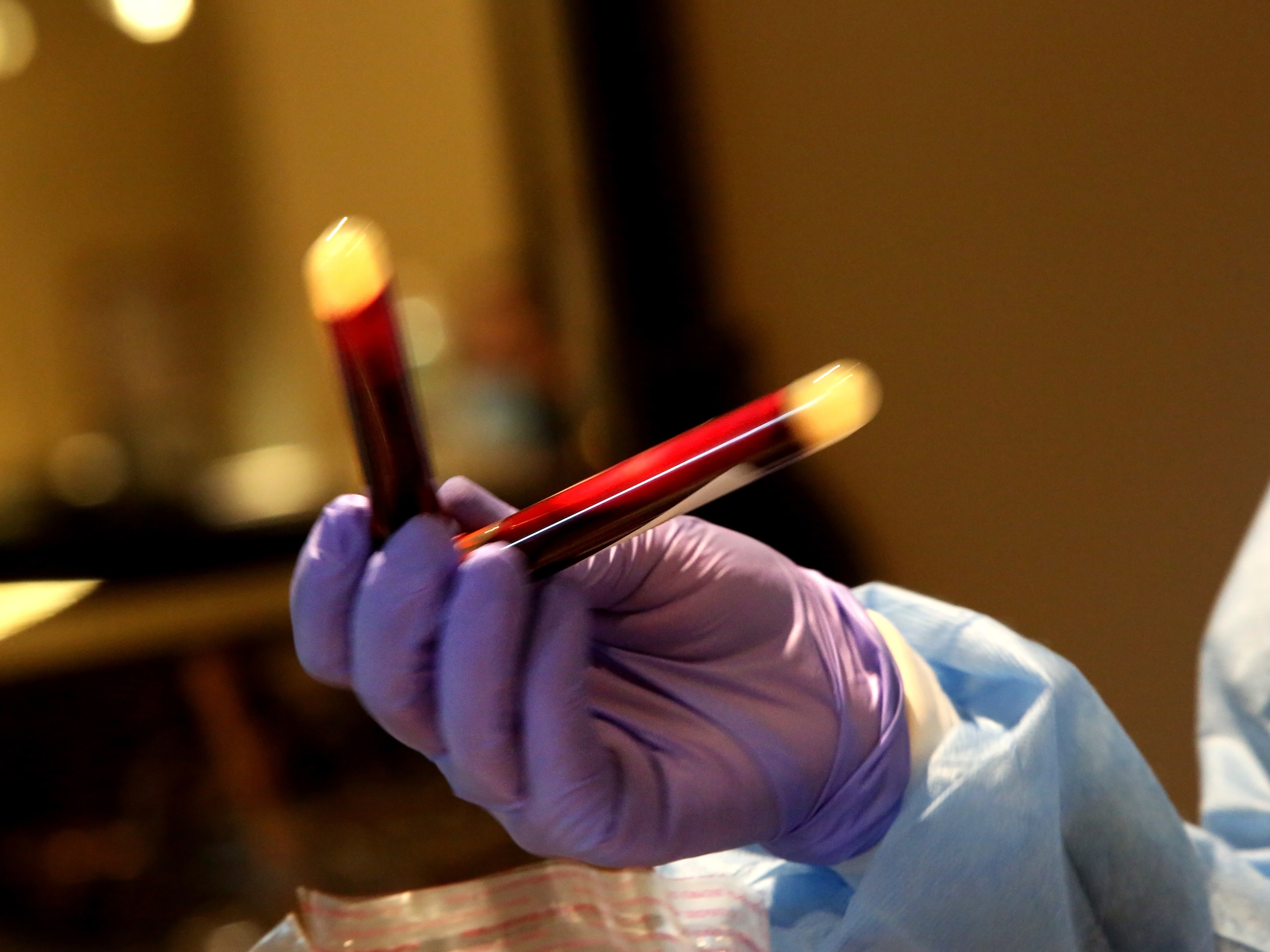 caption: A new study that analyzed blood donations from December 2019 to early January helped show that the coronavirus infected people in the U.S. earlier than previously thought.